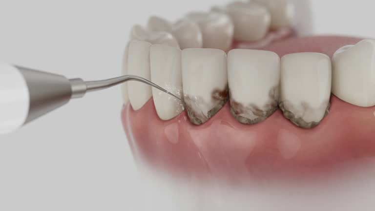 Reliable Dental contractor in Clovis, NM by Smile Center Dentistry